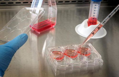 奥浦迈回应监管问询，深入解读产品竞争格局与技术地位